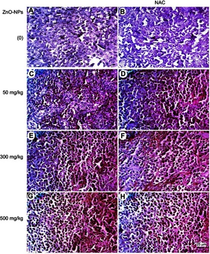 Figure 11 Photomicrographs represent immunohistochemistry staining of caspase-3 expression in ESC muscle sections showing (A) Negative staining of caspase-3 in ESC of untreated ESC group. (B) Negative staining of caspase-3 in ESC+NAC group. (C and D) ZnO-NPs (50 mg/kg) alone or combined with NAC, respectively, with moderate caspase-3 expression. (E and F) ZnO-NPs (300 mg/kg) alone or combined with NAC, respectively, show an increase in caspase-3 expression while groups. (G and H) ZnO-NPs (500 mg/kg) alone or combined with NAC, respectively, with the highest level of caspase-3 expression; 400× magnification.