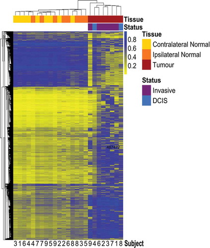 Figure 1. Heatmap with unsupervised hierarchical clustering based on Manhattan distance of tumour, ipsilateral-normal, and contralateral-normal methylation profiles.