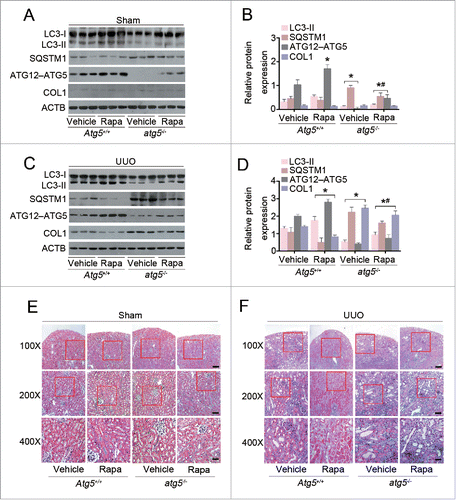 Figure 4. Atg5 deficiency abolishes the protective effect of rapamycin against renal fibrosis in mice. (A) Immunoblot analyses of proteins in the sham-operated kidneys of Atg5+/+ and atg5−/− mice treated with or without rapamycin. (B) Relative expression levels of the indicated proteins normalized to ACTB in Atg5+/+ and atg5−/− mice treated with or without rapamycin. Data are means ± SEM (n = 6); *, P < 0.001 vs. vehicle-treated Atg5+/+ mice; #, P < 0.05 vs. rapamycin-treated Atg5+/+ mice. (C) Immunoblot analyses of proteins in the kidneys at day 7 after UUO in Atg5+/+ and atg5−/− mice treated with or without rapamycin. (D) Relative expression levels of the indicated proteins normalized to ACTB in Atg5+/+ and atg5−/- mice treated with or without rapamycin. Data are means ± SEM (n = 6); *, P < 0.001 vs. vehicle-treated Atg5+/+ mice; #, P < 0.05 vs. rapamycin-treated Atg5+/+ mice. (E) Representative micrographs of kidney histology with Masson's trichrome staining from Atg5+/+ and atg5−/− mice. Scale bar: 80 (upper panels), 40 (middle panels), and 20 (lower panels) μm.