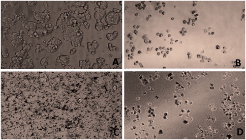 Figure 4. Bright field microscopy of HT29 cancer cells on treatment with nanoparticles at 50 μg/ml. Control (A), gold nanoparticle (B), iron oxide nanoparticle (C) and Zinc oxide nanoparticle (D).