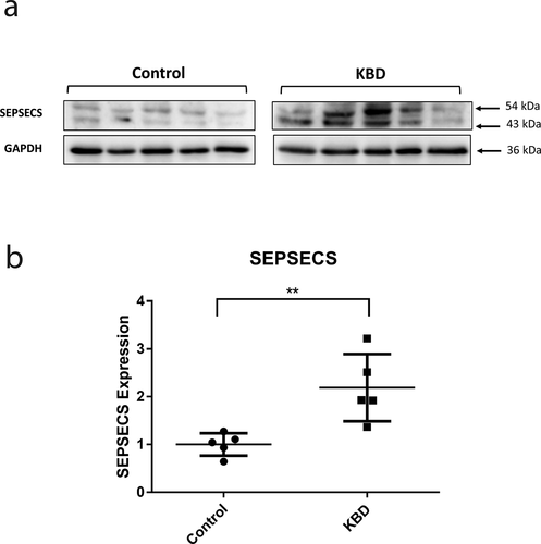 Figure 7. The expression of SEPSECS protein in the KBD and control chondrocytes. The expression of SEPSECS protein in KBD chondrocytes and normal chondrocytes (a). **P = 7.10 × 10−3 (b).
