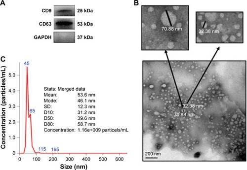 Figure 1 Characterization of exosomes isolated from the serum of HCC patients.