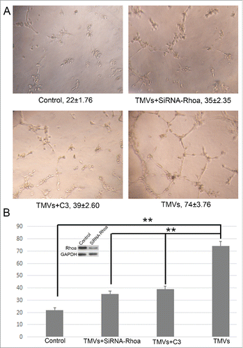 Figure 6. The effect of knockdown of RhoA on tube formation of HUVECs in vitro. A, The phase-contrast micrographs showed that TMVs enhanced network formation of HUVECs on Matrigel. The effect of TMVs-enhanced angiogenesis was inhibited by silencing the RhoA expression. The treatment condition and the actual number of branch points ± SEM were underneath the image. Branch points were used to quantify angiogenesis. B, As the histogram shown, the role of knockdown of RhoA in TMVs-mediated angiogenesis was similar with the data using C3. The western blot bands inserted in histogram showed the effect of silencing of RhoA. A difference of P < 0.05 was considered significant.