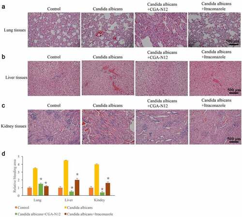 Figure 4. CGA-N12 significantly relieved histological damage caused by C. albicans. (a) Histological damage of lung tissues was remarkably relieved by CGA-N12; (b) Histological damage of liver tissues was remarkably relieved by CGA-N12; (c) Histological damage of kidney tissues was remarkably relieved by CGA-N12; (d) The bleeding areas were significantly decreased by CGA-N12.