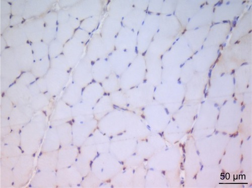 Figure 2 In the micrograph of the picroside group, brown staining is observed in a small number of cells showing immunoreaction by TUNEL staining. Magnification: ×400.