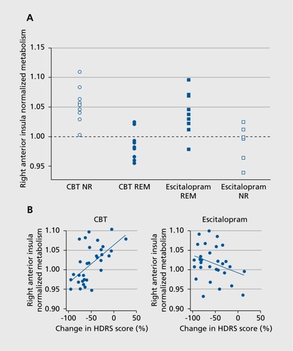 Figure 1. (A) Scatterplot of pretreatment 2-[18F]-fluoro-2-deoxyD-glucose positron emission tomography (PET) metabolic activity in the anterior insular cortex of individual patients remitting (REM) and not responding (NR) to treatment with either escitalopram or cognitive behavioral therapy (CBT). Normalized metabolic activity in the anterior insula subdivided patients into hypermetabolic and hypometabolic subgroups. (B) Insula activity correlated with changes in the Hamilton Depression Rating Scale (HDRS) score in the full cohort of subjects treated with either CBT or escitalopram oxalate. From reference 28: McGrath CL, Kelley ME, Holtzheimer PE, et al. Toward a neuroimaging treatment selection biomarker for major depressive disorder. JAMA Psychiatry. 2013:70:821-829.