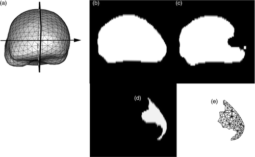Figure 3. Representation of the planar cut to be included in the biomechanical model. (a) Surface mesh of the biomechanical model showing the location of the plane where the retractor was inserted. This plane corresponds to the plane separating the two hemispheres. (b) Whole-brain region segmented out from the second iMR image, acquired before retraction, in the selected plane shown in (a). (c) Whole-brain region segmented out from the the third iMR image, acquired after retraction. (d) Cut defined as the difference between (b) and (c), where (c) has been processed beforehand to remove small, isolated islands. (e) Surface mesh representing the intersections of the cut with the volume mesh of the whole-brain region brain.