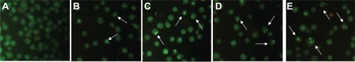 Figure 4 Nuclear morphologic changes of multidrug resistant K562/A02 leukemia cells after different treatments for 48 hours.