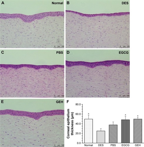 Figure 10 Representative images of H&E-stained corneal sections in the five groups.Notes: (A) Corneal sections from controls, showing three to five epithelial layers. Corneal sections from (B) 0.1% benzalkonium chloride-treated eyes (DES mimic) and (C) PBS-treated eyes, showing destruction of the layered structure and sponge-like stroma. Corneal sections from (D) EGCG- and (E) GEH-treated eyes. (F) Thickness of corneal epithelium layers (*P<0.05 compared with DES).Abbreviations: DES, dry-eye syndrome; EGCG, epigallocatechin gallate; GEH, gelatin–EGCG with hyaluronic acid coating.