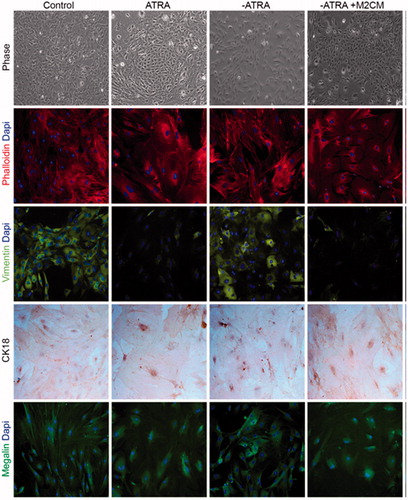Figure 4. Effect of anti-inflammatory M2 supernatants on epithelial to mesenchymal transition markers. Phase contrast images and immunofluorescence of phalloidin, vimentin, megalin, and cytokeratin18 (CK-18) in ASC untreated (Control); ASC treated with ATRA for 7 days (ATRA); below ATRA withdrawal for 24 h (−ATRA); ATRA withdrawal followed by anti-inflammatory macrophages conditioned medium for 24 h following (−ATRA + M2CM)), Phase-contrast images and phalloidin staining of F-actin cytoskeleton (red) nuclei (blue). In addition, immunofluorescence of vimentin (green), nuclei (blue). Immunocytochemistry of CK18, nuclei counterstained with hematoxylin. Immunofluorescence of megalin (green), nuclei (blue). Images were obtained by phase contrast microscopy, immunofluorescence, and immunocytochemistry. Magnification 20×.