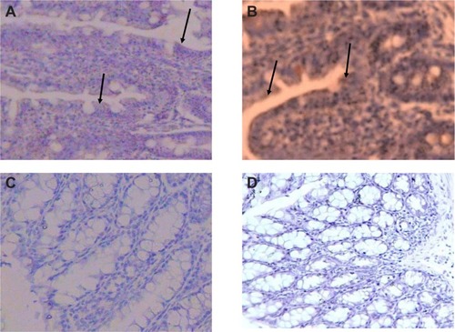 Figure 5 Immunohistochemical staining of the colon and distal ileum. Specimens of mouse colon and ileum were studied immunohistochemically for the presence of CXCR4 (integral membrane proteins). Sections labeled with goat antirabbit immunoglobulin G horseradish peroxides and developed with 3,3′-diaminobenzidine produced a brown color and were counterstained with hematoxylin (blue color). Immunohistochemical staining of the colon and distal ileum showed strong immunoreactivity in the colon and distal ileum in group A. Arrows show CXCR4 protein (magnification 40×) (A). Moderate immunoreactivity was detected in the colon and distal ileum in group D. Arrows show CXCR4 protein (magnification 40×) (B). Faint immunoreactivity was detected in the colon in group E (magnification 40×) (C). Faint to negative immunoreactivity was detected in the colon in group F (magnification 40×) (D).