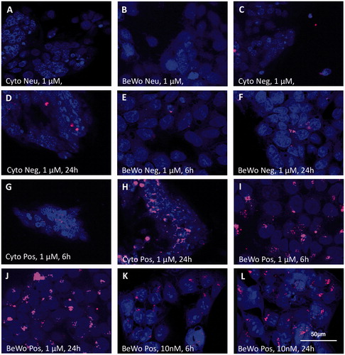 Figure 2. Localization of differently charged (neutral (Neu; A,B), negative (Neg; C–F), positive (Pos; G–L)), labeled dPG-NPs (pink) in exposed primary cytotrophoblasts (A–D,G,H), and BeWo cells (B,E,F,I–L). Exposure concentrations: 1 µM (A–J) and 10 nM (K,L)), exposure time: 6 h (C,E,G,I,K), and 24 h (A,B,D,F,H,J,L). Nuclear staining: DAPI (blue). Confocal images, 400x. Patchy perinuclear and nuclear localization was seen after 6 h of exposure to 1 µM neg. dPG-NPs (C,E) and pos. dPG-NPs (G,I), increasing after 24 h. Notably, in BeWo cells pos. dPG-NP deposits were also detected after exposing them to a 10 nM concentration for 6 h (K) and 24 h (L). No neutral dPG-NP deposits were detected in both cell types (A,B).