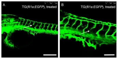 Figure 6 Inhibitory effects of SWCNT-conjugated thalidomide on angiogenesis in transgenic zebrafish embryos. Transgenic fli1a:EGFP zebrafish embryos were treated with 0.334 mg/mg thalidomide-SWCNT (thalidomide concentration, 1.2 mg/mL of SWCNT) from 4 hours following fertilization to 48 hours following fertilization, and then visualized live under a Leica SPE confocal microscope. The absence (A) and thinning (B) of intersegmental blood vessels, as indicated by the white arrows, is randomly distributed in zebrafish embryos after treatment with SWCNT-thalidomide. Scale bar: 250 μm in (A) and 100 μm in (B).Abbreviation: SWCNT, single-walled carbon nanotubes.