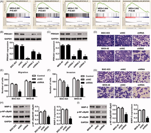 Figure 3. PRKAA1 knockdown inhibits the GC cell migration and invasion in vitro. (A) GSEA demonstrated the genes of metastasis were correlated with GC patients with PRKAA1 low vs. PRKAA1 high. (B, C) shRNA targeted PRKAA1 in both MKN-45 and BGC-823 cells significantly reduced PRKAA1 protein expression. MKN-45 and BGC-823 cells were transduced with shRNA targeted PRKAA1, and the migration (D, E) and invasion (F, G) were measured by Transwell assay. Scale bars: 100 μm. BGC-823 (H) and MKN-45 (I) cells were transduced with shRNA targeting PRKAA1 and the protein expression of MMP-2, p-NF-κBp65 and NF-κBp65 was measured by Western blotting. **p<.01 compared with shNC.