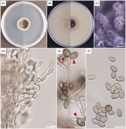 Figure 1. Cultural and morphological characteristics of UD CT 1-3-3. (A) Colonies on potato dextrose agar (PDA); (B) Colonies on oatmeal agar (OA) for 14 days of incubation at 25 °C; (C) Synnemata; (D) Apical portion of a synnema; (E) Polyblastic conidiogenous cells; (F) Conidia. Arrows indicate conidiogenous cells. Scale bars: C = 200 μm; D–F = 10 μm.