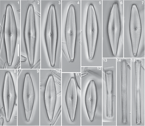 Figs 1–15. Afrocymbella barkeri sp. nov., holotype BR 4404 from material CCA 3421, Lake Challa, Kenya. Figs 1–12. Valves showing the size range. Figs 13–15. Girdle views. Figs 14–15. Girdle views from the same frustule taken at different foci. Fig. 7. Valve representing the holotype. LM. Scale bar = 10 µm.