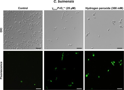 Figure 6 Images of reactive oxygen species assay detection in Candida buinensis cells after treatment with γ33-41PνD1++ (25 µM) for 24 hours. Control cells were treated only with the 2′,7′-dichlorofluoresceindiacetate probe and positive control cells were treated with 300 mM hydrogen peroxide. Bars =20 µm.Abbreviation: DIC, differential interference contrast.
