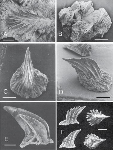 FIGURE 6. Shagreen denticles in other hybodonts. A, B, denticles from trunk region in Egertonodus fraasi, from Maisey (Citation1986). C, D, denticles from top of head in Egertonodus basanus, from Maisey (Citation1983). E, denticles from trunk in Hamiltonichthys mapesi, from Maisey (Citation1989). F, denticles said to be from near the mouth in Hybodus delabechei, after Reif (Citation1978). Scale bars equal 200 μm (A, C, D), 1 mm (B), 100 μm (E), and 500 μm (F).