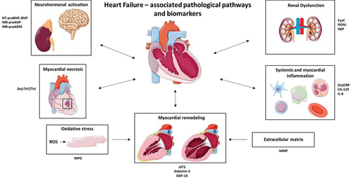 Figure 1. Main pathological pathways involved in heart failure and a selection of associated biomarkers. NT-proBNP, N-terminal pro hormone BNP. BNP, Brain natriuretic peptide. MR-proANP, Mid-regional pro atrial natriuretic peptide. MR-proADM, Mid-regional proadrenomedullin. (hs)-TnT/TnI, (high sensitivity) – troponin T/I. MPO, myeloperoxidase. sST2, soluble suppression of tumorigenesis 2. GDF-15, Growth-differentiation factor 15. MMP, Matrix metalloproteinase. (hs)CRP, (high sensitivity) C-reactive protein. CA-125, Cancer antigen 125. NGAL, Neutrophil gelatinase-associated lipocalin. Parts of the figure were drawn by using pictures from Servier Medical Art licensed under a Creative Commons Attribution 3.0 unported license.