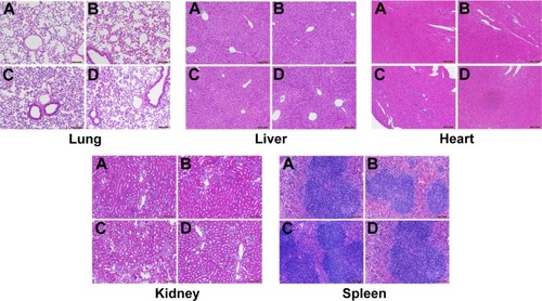 Figure 8 HE staining of major organs (n=8).Notes: BALB/c mice were randomly divided into four groups and were injected with 0.1 mL of saline (A), or 1 mg/kg (B), 10 mg/kg (C), or 100 mg/kg (D) of SDF-1α-PPADT nanoparticles resuspended in saline through the tail vein. Histological examination of the major organs and tissues showed no morphological abnormalities or infiltration of inflammatory cells.Abbreviations: SDF-1α-PPADT, SDF-1α-loaded PPADT; SDF-1α, stromal cell-derived factor-1α; PPADT, poly-(1,4-phenyleneacetone dimethylene thioketal); HE staining, hematoxylin-eosin staining.