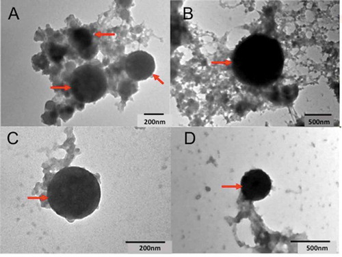 Figure 3. Determination of the presence of bacteria-like structures in U. maydis protoplasts. Electron microscopy of negatively stained broken protoplasts: A) FB2, B) TA (Llera, Tamaulipas), C) OA (San Juan Teltipac, Oaxaca), D) PU (Tehuacán, Puebla). Scale bar for electron microscopy: A and C 200 nm; B and E 500 nm