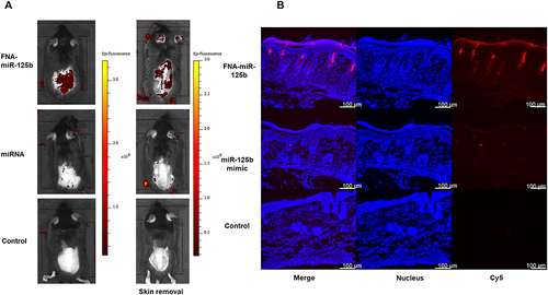 Figure 3 Skin penetration capability of FNA-miR-125b in the mouse back skin. (A) IVIS in vivo imaging; (B) Histology analysis of skin section post the treatment of FNA-miR-125b and miR-125b mimic (nucleus: blue Cy5: red).