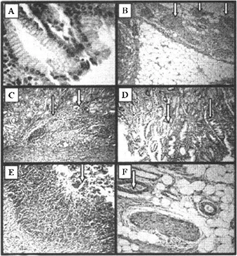 Figure 3. Histological haematoxylin/eosin (HE) analysis of experimental gastric ulcers induced by gamma irradiation. Stomach of healthy mice (A), HE × 10; nerve endings in the underlying tissue of the stomach in healthy mice (B), HE × 40; ulceration on the 4th hour after irradiation (C) – noduli lymphatici (thin arrow) and dilated vessel (thick arrow), HE × 40; and vacuolization (D) of the stomach epithelium (thin arrow) and area of normal epithelium (thick arrow), HE × 40; stomach integrity on the 12th hour (E) and 24th hour (F) after radiation exposure; HE × 40.