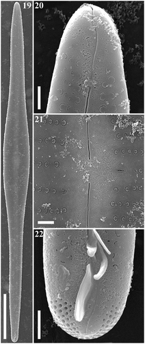 Figs 19–22. Gomphonema longissimum, strain Ind394, Lake Matano, Indonesia, SEM, external views. Fig. 19. Whole valve. Fig. 20. Head pole. Fig. 21. Details of valve at centre. Fig. 22. Foot pole with pore field. Scale bars: Fig. 19, 20 µm; Figs 20–22, 1 µm.