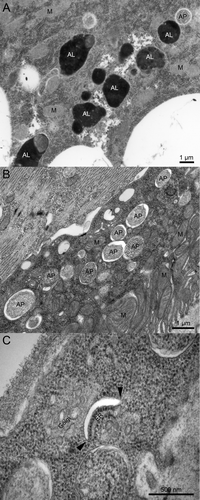 Figure 1. Ultrastructural images of wild-type and Syx17 mutant Drosophila cells from early L3 stage larvae starved for 3 h. (A) Both autophagosomes (AP) and electron-dense autolysosomes (AL) can be observed in various tissues of starved control larvae, such as the fat body shown here. M, mitochondrion. (B) Typical double-membrane autophagosomes accumulate in large numbers in starved Syx17 mutant larvae, illustrated by a Malpighian tubule cell in this image. (C) This panel shows a rarely observed phagophore in a Syx17 mutant cell, which appears as a curved, nonbranching membrane cistern with a characteristic cleft between the two membranes after standard glutaraldehyde fixation. While the empty-looking space is an artifact, it greatly facilitates the identification of early autophagic structures. Arrowheads point to the edges of the phagophore, where the transitions of prospective outer and inner membrane layers are clearly visible.
