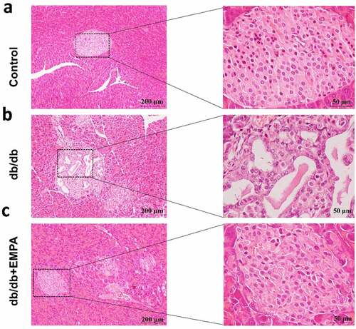 Figure 4. Hematoxylin and Eosin staining of histological sections of mice pancreas. (a) The blank control group. (b) The db/db group. (c) The db/db+EMPA group