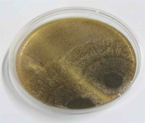 Plate 3. A photograph showing Aspergillus niger resident in the shrimp cultured on OGYE media at 30°C