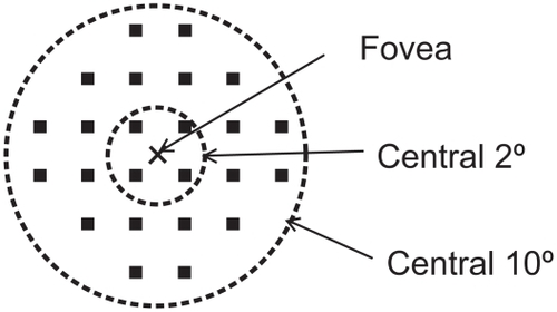 Figure 1 Results of microperimetry. Twenty-four loci covering the central 10° were examined by Micro Perimeter 1 (MP1). Four measurement points were located within the central 2° of the macula, and 24 measurement points were located within the central 10° of the macula.