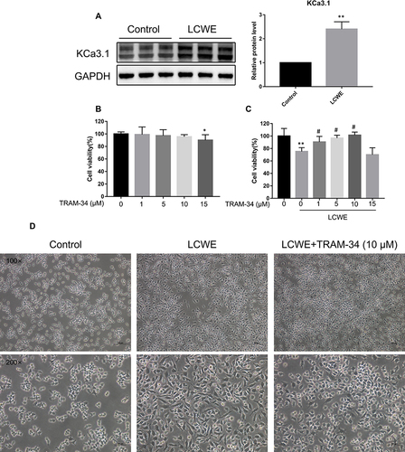 Figure 1 Effects of KCa3.1 inhibition by TRAM-34 on LCWE-induced cytotoxicity and activation in RAW264.7 cells. (A) RAW264.7 cells were stimulated with LCWE (1 μg/mL) for 12 h. The protein level of KCa3.1 was detected by Western blot. Results are expressed as the mean ± SD. **p < 0.01 versus control group. (B, C) Cytotoxicity of RAW264.7 cells treated by TRAM-34 (0, 1, 5, 10, 15 μM) with or without LCWE (1 μg/mL) was determined by CCK8 assay. Results (n = 5) are expressed as the mean ± SD, * p < 0.05, **p < 0.01 versus untreated group, # p < 0.05 versus LCWE-treated group. (D) The representative microphotographs showed phenotypic changes of RAW 264.7 cells in responsive to different stimuli (LCWE (1 μg/mL), TRAM-34 (10 μM)) for 12 h. Magnification = 100× or 200×. Scale bar = 100 µm.