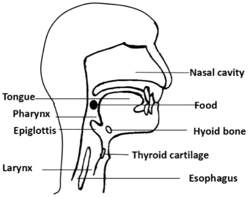 Figure 1. Anatomical structures of dysphagia.
