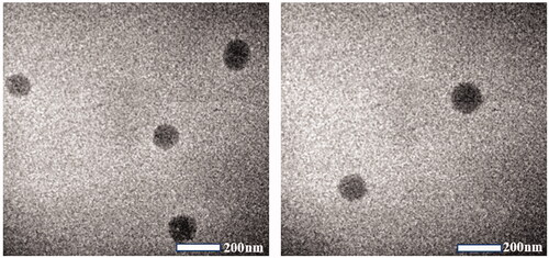Figure 4. The TEM images of blank NLC (left) and SRB-NLC (right).