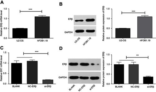 Figure 2 The expression of ERβ in U2-OS and hFOB1.1 cells detected by qRT-PCR and Western blot. (A and C) Relative expression of ERβ at mRNA level (qRT-PCR); (B and D) relative expression of ERβ at protein level (Western blot). si-ERβ, U2-OS cells transfected with siRNA-ERβ for 48 hrs; NC-ERβ, U2-OS cells transfected with siRNA-negative control-ERβ for 48 hrs; blank, U2-OS cells without transfection. **P<0.01; ***P<0.001.Abbreviations: ERβ, estrogen receptor β; OS, ostemsarcoma; qRT-PCR, quantitative real-time PCR; GAPDH, glyceraldehyde-3-phosphate dehydrogenase; NC, negative control; si, small interfering RNA.