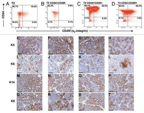 Figure 5 Histological and FACS profiles of subpopulation-derived tumors compared to the donor tumor. Donor tumor T2 (A, E, I, M and Q) and tumors resulting from orthotopic transplantation of 1,000 T2 Lin−/CD24+/CD49f− cells (B, F, J, N and R), 1,000 T2 Lin−/CD24+/CD49f+ cells (C, G, K, O and S) or 5,000 T2 Lin−/CD24−/CD49f+ cells (D, H, L, P and T) are shown. Single color controls (Lin-Cy5, CD24-FITC, CD49f-PE or PI) were included in each FACS experiment, with compensation done by the software. Bars represent 50 µm.