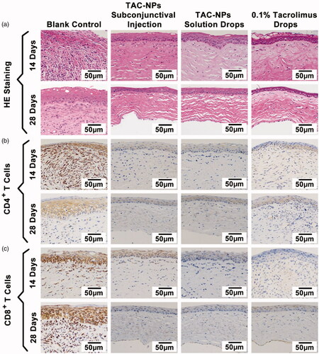 Figure 3. HE and immunohistochemical staining of corneal grafts (magnification, 200×). (a) HE staining, (b) immunohistochemical staining of CD4+ T cells, and (c) immunohistochemical staining of CD8+ T cells. Greater numbers of CD4+ and CD8+ T cells (stained in brown) were observed in the blank control group than in the TAC-NP-treated and 0.1% tacrolimus-treated groups.