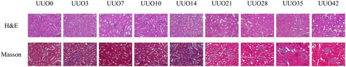 Figure 2. Histological analysis (H&E & Masson staining, × 200) of contralateral kidneys from the UUO models revealed varying degrees of pathological changes. These included swelling of the renal tubular epithelial cells, increasing numbers of inflammatory cells, dilation and deformation of renal tubules, and progressive glomerulosclerosis over time. Masson staining results demonstrated a corresponding increase in fibrosis severity in the contralateral kidney with the duration of left ureteral obstruction, particularly evident in the medulla.