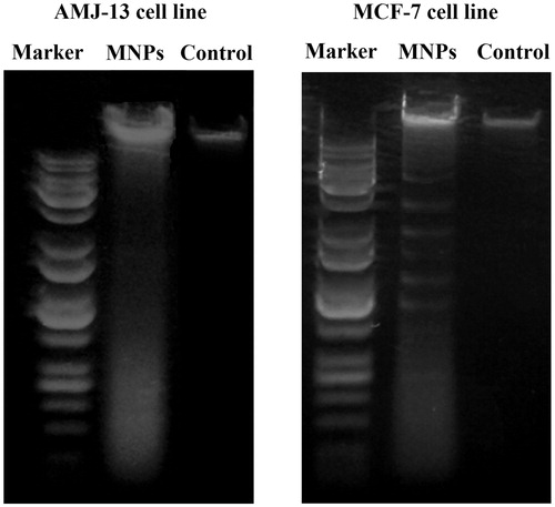 Figure 16. UV-illumination of fragmented DNA band images of cancer cells. AMJ-13 cell line (left lane), and MCF-7 cell line (right lane). Marker with molecular weight ranged from 100 to 10,000 bp was used.