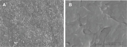 Figure 2 Scanning electron microscopy images of surface morphology of (A) nanofluorapatite (n-FA)/polyamide 12 (PA12) composite with 40 wt% n-FA and (B) PA12.
