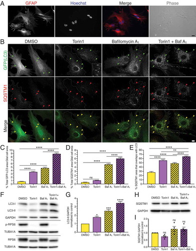 Figure 1. Inhibition of MTOR activates SQSTM1-mediated selective autophagy in primary astrocytes. (A) Immunostaining analysis and phase image of primary mouse cortical glia enriched for astrocytes (GFAP; astrocyte-specific marker). Bar: 20 µm. (B) Maximum projections of z-stacks of GFP-LC3 transgenic astrocytes treated with the MTOR inhibitor torin1 for 4 h and immunostained for GFP and SQSTM1. Arrowheads denote puncta co-positive for GFP-LC3 and SQSTM1. Outlines define cell boundaries. Bar: 10 µm. Inset bar: 1 µm. (C) Quantification of total GFP-LC3 puncta area normalized to cell area of astrocytes treated with torin1 for 4 h (mean ± SEM; one-way ANOVA with Tukey’s post hoc test; n = 54–96 cells from 3 independent experiments, 5–7 DIV). (D) Quantification of total SQSTM1 puncta area normalized to cell area of astrocytes treated with torin1 for 4 h (mean ± SEM; one-way ANOVA with Tukey’s post hoc test; n = 64–94 cells from 3 independent experiments, 5–7 DIV). (E) Quantification of the percentage of SQSTM1 puncta area that overlaps with GFP-LC3 puncta area in astrocytes treated with torin1 for 4 h (mean ± SEM; one-way ANOVA with Tukey’s post hoc test; n = 53–82 cells from 3 independent experiments, 5–7 DIV cells). (F and G) Immunoblot analysis and corresponding quantification of lysates generated from glia treated for 4 h with torin1. (F) GAPDH and TUBA1A/α-tubulin serve as loading controls; horizontal lines designate individual blots. (G) LC3-II levels were normalized to GAPDH (mean ± SEM; one-way ANOVA with Dunnett’s post hoc test; n = 3 independent experiments, each experiment was performed with technical replicates, 3–6 DIV). (H and I) Immunoblot analysis and quantification of SQSTM1 levels in glia treated with torin1. SQSTM1 levels were normalized to GAPDH (mean ± SEM; one-way ANOVA with Dunnett’s post hoc test; n = 4 independent experiments, 6–8 DIV). Baf A1, bafilomycin A1.