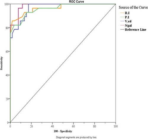 Figure 7. ROC curve for RI, PI, V.ed, and Ngal to predicate AKI patients