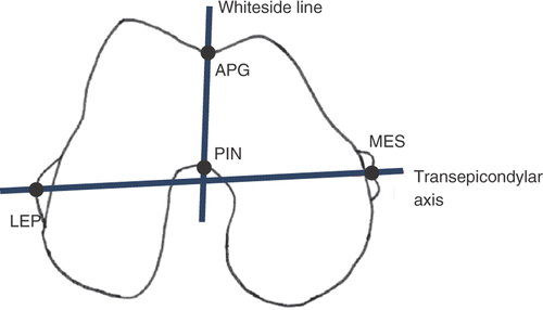 Figure 1. Diagram of the Whiteside line and transepicondylar axis along with the four point landmarks, namely, the deepest part of the anterior patellar groove (APG), the center of the posterior intercondylar notch (PIN), the lateral epicondylar prominence (LEP) and the median sulcus of the medial epicondyle (MES), conventionally considered to trace the two axes.