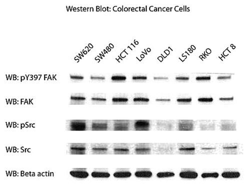 Figure 1. Expression of phosphorylated FAK, Src, and total FAk and Src in different colon cancer cell lines. Western blot shows the expression of FAK and Src proteins and their phosphorylated counterparts (pY397 FAK, pY418-Src); β actin was used as a control for equal loading.