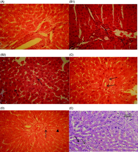 Figure 5. Histopathological studies. (A) LAP group, the portal tract and the hepatocytes in normal condition. (B1) CLP group, neutrophil infiltration in the portal tract (arrows). (B2) CLP group, neutrophil infiltration in the sinusoids which can be seen easily with their dark nuclei (arrows). (C) E.O50, mild infiltration of neutrophils in the portal tract (arrows). H&E, 400*. (D) E.O100 group, reduced neutrophil infiltration (arrow head) and a few Kupffer cells (thin arrow) could be seen in the picture. H&E, 400*. (E) Indomethacin group, a few infiltrated neutrophils (arrows) could be seen in the picture. H&E, 400*.