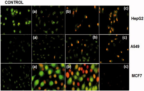 Figure 5. Cells stained with AO and EB of CS/PLA-PIC treated HepG2, A549, and MCF cells at 24 h. Cells without treatment (control) HepG2 cells treated with (a) 20 µg/ml, (b) 40 µg/ml and (c) 60 µg/ml. A549 cells treated with (a) 40 µg/ml, (b) 60 µg/ml and (c) 80 µg/ml. MCF7 cells treated with (a) 40 µg/ml, (b) 60 µg/ml and (c) 80 µg/ml.