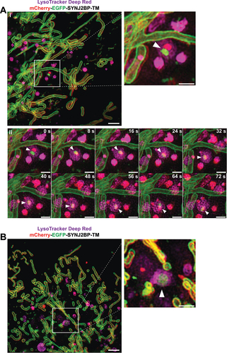 Figure 5. Three-dimensional (3D) structured illumination microscopy (SIM) live cell imaging of mCherry-EGFP-SYNJ2BP-TM H9c2 cells captures mitochondrial fragments within acidic structures. (Ai) A still frame overview image (merged channels) from the start of Video S1 displaying a cell during normal culture conditions after adding the LysoTracker Deep Red dye (100 nM for 40 min). The boxed area indicates a mitochondrial fragment with both EGFP and mCherry fluorescence inside a LysoTracker Deep Red-positive structure. The channels for red and green fluorescence are slightly shifted due to the time-delay between images of the different channels. The region of interest is shown as an enlarged image and the structure is highlighted with an arrowhead. (Aii) A time series of the boxed area in Video S1 following the movement of the lysosome containing the mitochondrial fragment (arrowhead). (B) A still frame overview image (merged channels) from the start of Video S2 displaying a cell after galactose adaptation after adding the LysoTracker Deep Red dye (100 nM for 40 min). The boxed area indicates a mitochondrial fragment with both EGFP and mCherry fluorescence inside a LysoTracker Deep Red-positive structure. The region of interest is shown as an enlarged image with the identified structure highlighted with an arrowhead. Max projection was utilized for all the images. Scale bars: 2 μm (overview images) and 1 μm (the enlarged images and for the time series).