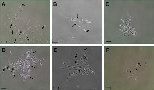 Figure 8 Phase-contrast micrographs of PC-12 neurites at day 3.Notes: (A) Treatment with 50 ng/mL NGF. (B) Treatment with 50 μg/mL of HAE of H. erinaceus. (C) Negative control (complete F-12 K medium). (D–F) Various concentrations of AuNPs ranged from 200 to 600 ng/mL. Scale bar =20 μm. Arrows indicate neurite extensions.Abbreviations: AuNPs, gold nanoparticles; NGF, nerve growth factor; H. erinaceus, Hericium erinaceus; HAE, hot aqueous extract.