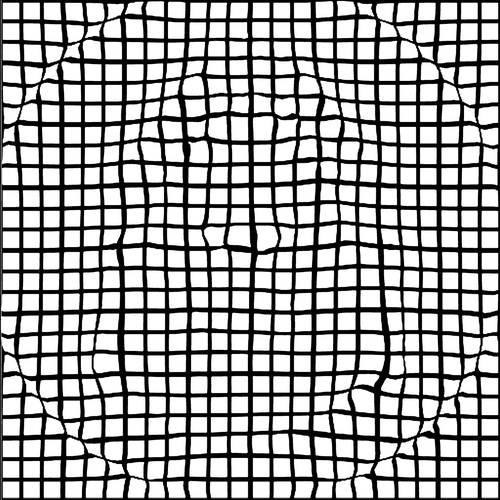 Figure 5.  Illustration of the transformation applied to the axial slice shown in Figure 4. The transform is used to deform a rectilinear grid with a grid spacing of 10 mm. Only the in-plane deformation can be seen.